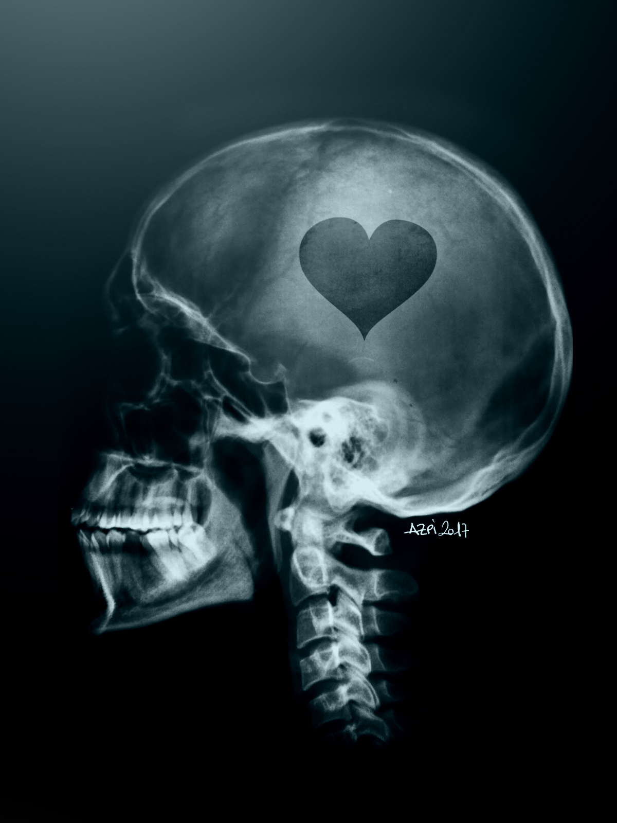 cerebro