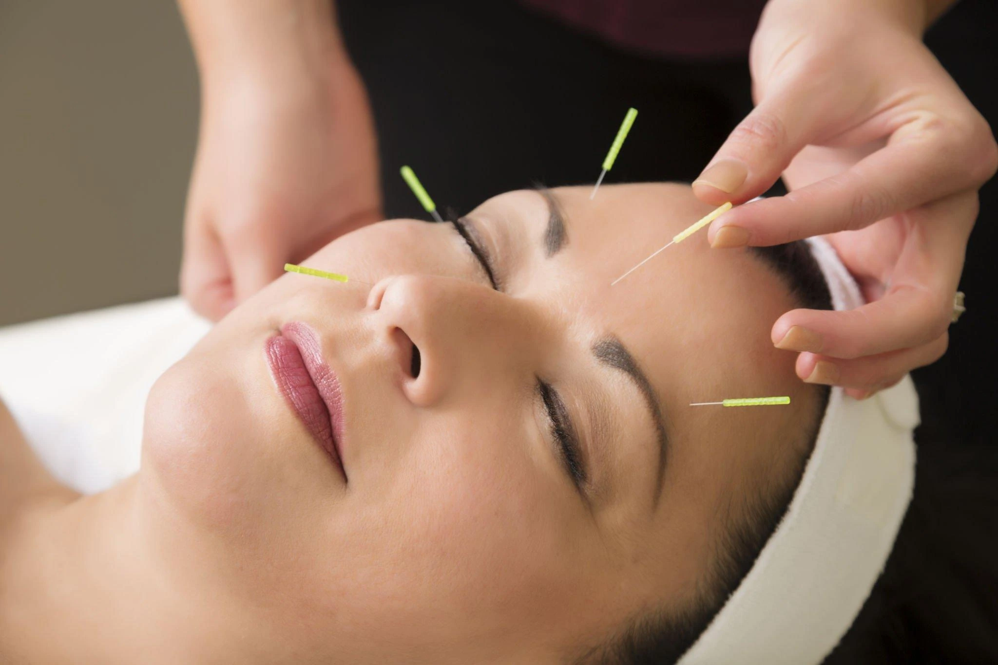 Do You Tip Acupuncturist?